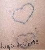 Tattoo-Entfernung ohne Lasern