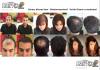 Lichtes Haar? Dünnes Haar? Haarprobleme? Haarverlust? Haarausfall? Alopezie? Hai