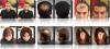 Lichtes Haar? Lichte Stellen? Dünnes Haar? Haarprobleme? Haarverlust? Haarausfal