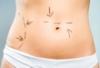 Schönheitsklinik/ Ästhetisch-plastiche Chirurgie in Stettin,  100% Leistung - 60% 