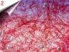 Laser Lace - Nagel Netz um 2,  40€