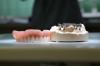 Implantatgetragene,  stegreitende,  herausnehmbare Deckprothese