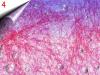 Laser Lace - Nagel Netz um 2,  40€